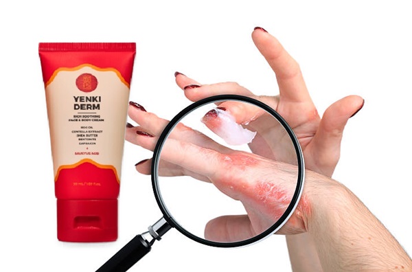 Yenki Derm creme Erfahrungen, Preis Deutschland