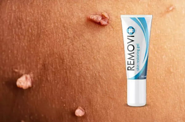 Was ist Removio Gel?