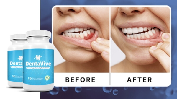 Wie man Dentavive anwendet