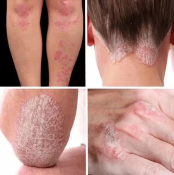 Dermasept: Zusammensetzung und Inhaltsstoffe