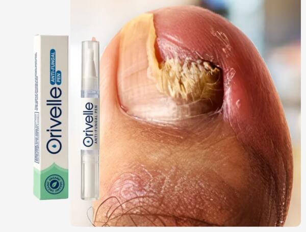 Orivelle Pen Deutschland - Preis Bewertungen Erfahrungen