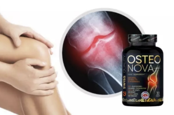 Osteonova-Preis in Deutschland und Österreich
